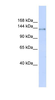 Polyclonal Rabbit anti-Human SUPT16H / FACTP140 Antibody (aa971-1020, WB)
