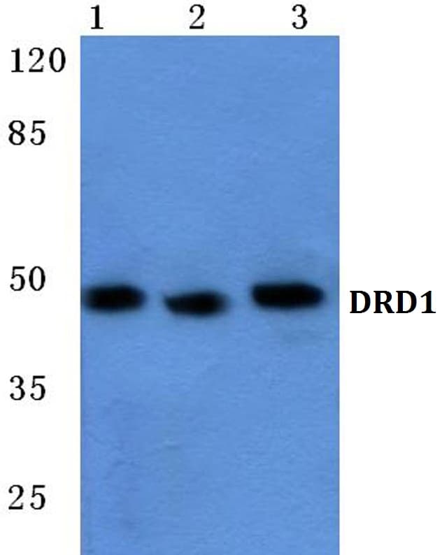 IHC-plus™ DRD1 / Dopamine Receptor D1 Antibody (aa187-232)
