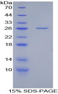 Rat Latexin / MUM Protein (Recombinant His)