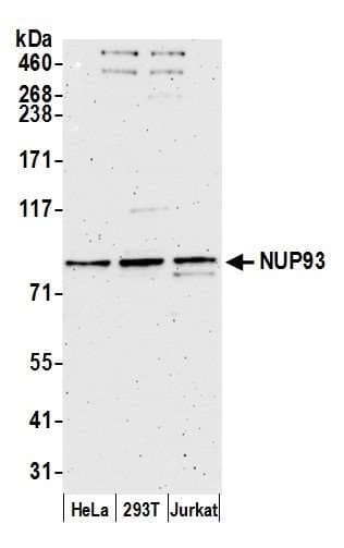 IHC-plus™ SNRPD3 Antibody (aa76-126)