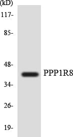 PPP1R8 / Rnase E Antibody (aa178-227)