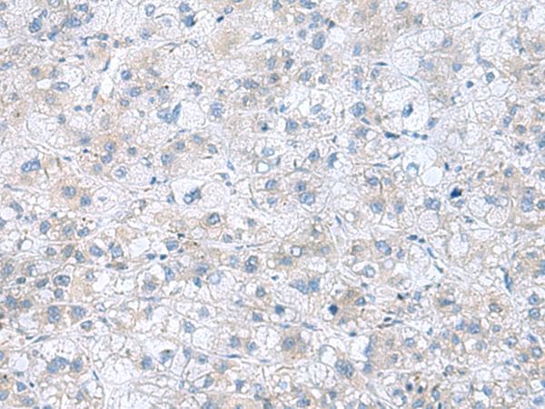 TXNDC12 Antibody