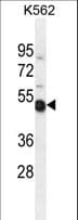 NME9 / TXNDC6 Antibody (aa111-139)