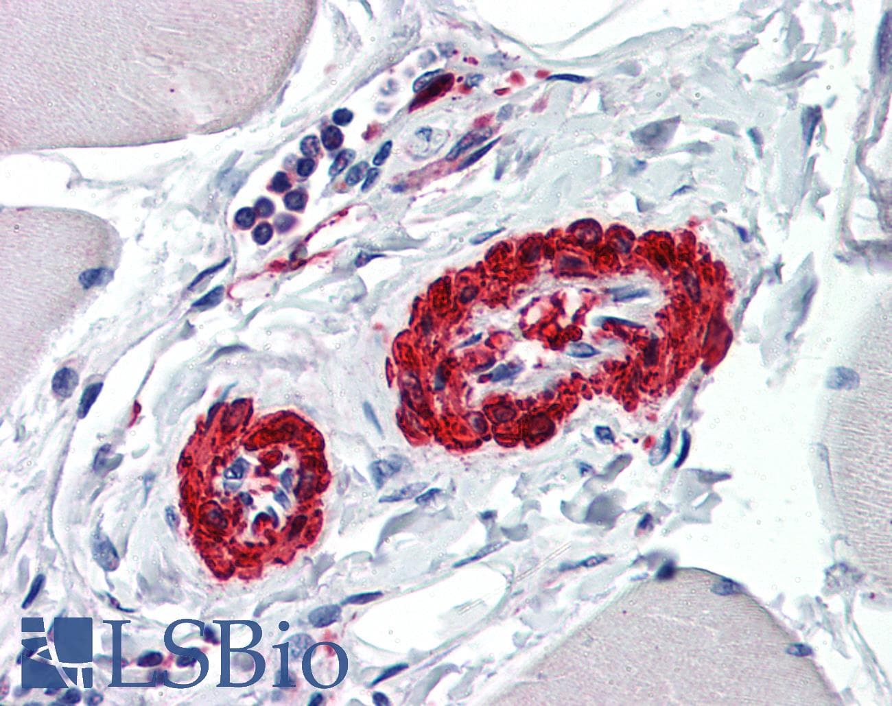IHC-plus™ ACTA2 / Smooth Muscle Actin Antibody (clone 1D11-2B9)