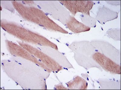 Monoclonal Mouse anti-Human LMNA / Lamin A+C Antibody (clone 4E7, IHC, WB)