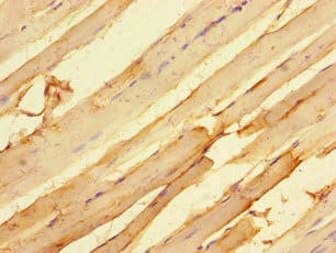 Polyclonal Rabbit anti-Human MTERF4 / MTERFD2 Antibody (IHC, IF, WB)