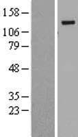BUB1B / BubR1 Protein (Over-Expression Lysate Myc-DDK (Flag))