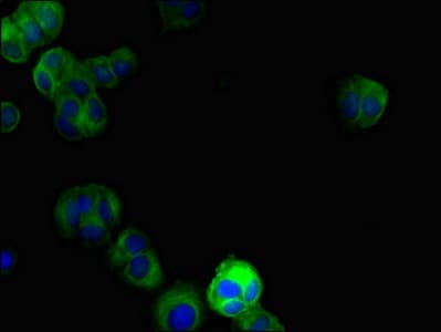 Polyclonal Rabbit anti-Human DRAM2 Antibody (IHC, IF, WB)
