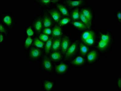Polyclonal Rabbit anti-Human SERPINB12 Antibody