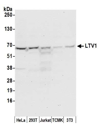 Polyclonal Rabbit anti-Human LTV1 Antibody (aa125-175, WB)