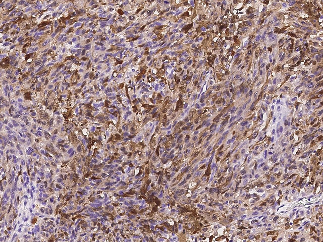 S100B / S100 Beta Antibody (clone 30, Preservative Free)