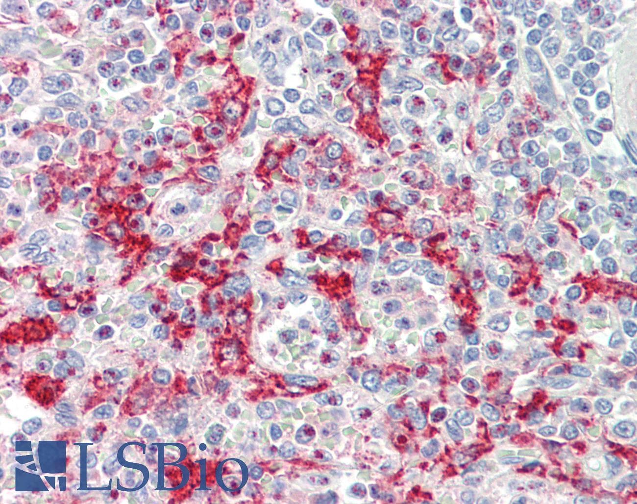 IHC-plus™ BUD31 Antibody (aa10-59)