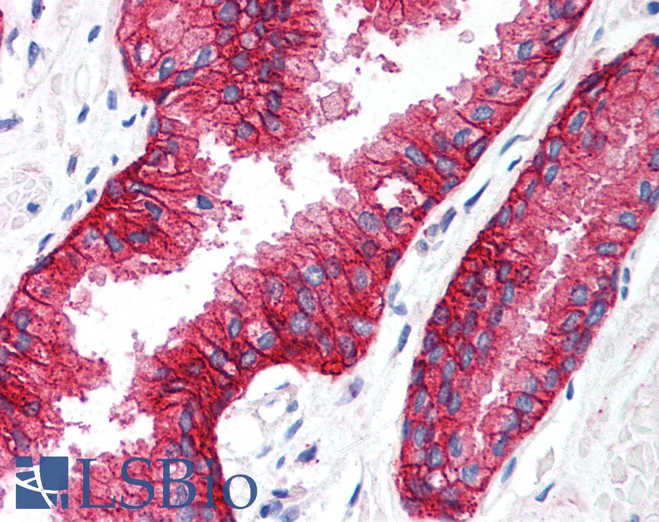IHC-plus™ KCNN4 / KCa3.1 Antibody (C-Terminus)