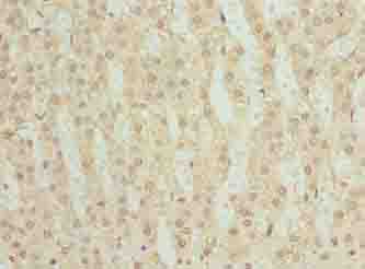 Polyclonal Rabbit anti-Human LYAR Antibody (IHC, WB)