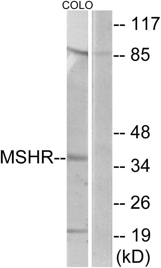 MC1R Antibody
