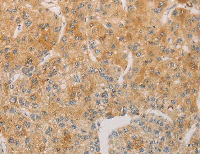 Polyclonal Rabbit anti-Human ACSL4 / FACL4 Antibody (IHC, WB)