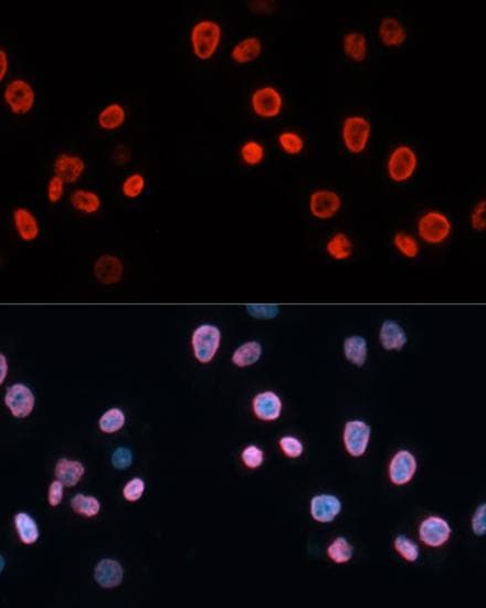 Polyclonal Rabbit anti-Human NSG1 Antibody (IF, WB)