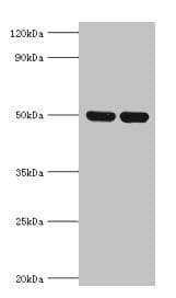 Polyclonal Rabbit anti-Human IDH2 Antibody (aa193-452, WB)