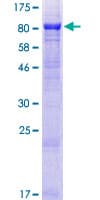 Human MON1B Protein (Recombinant GST)