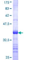Human MTRR Protein (Recombinant GST, N-terminus)