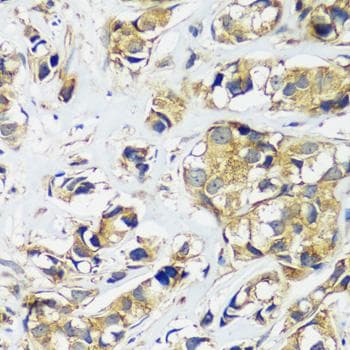 Polyclonal Rabbit anti-Human CCDC124 Antibody (IHC)