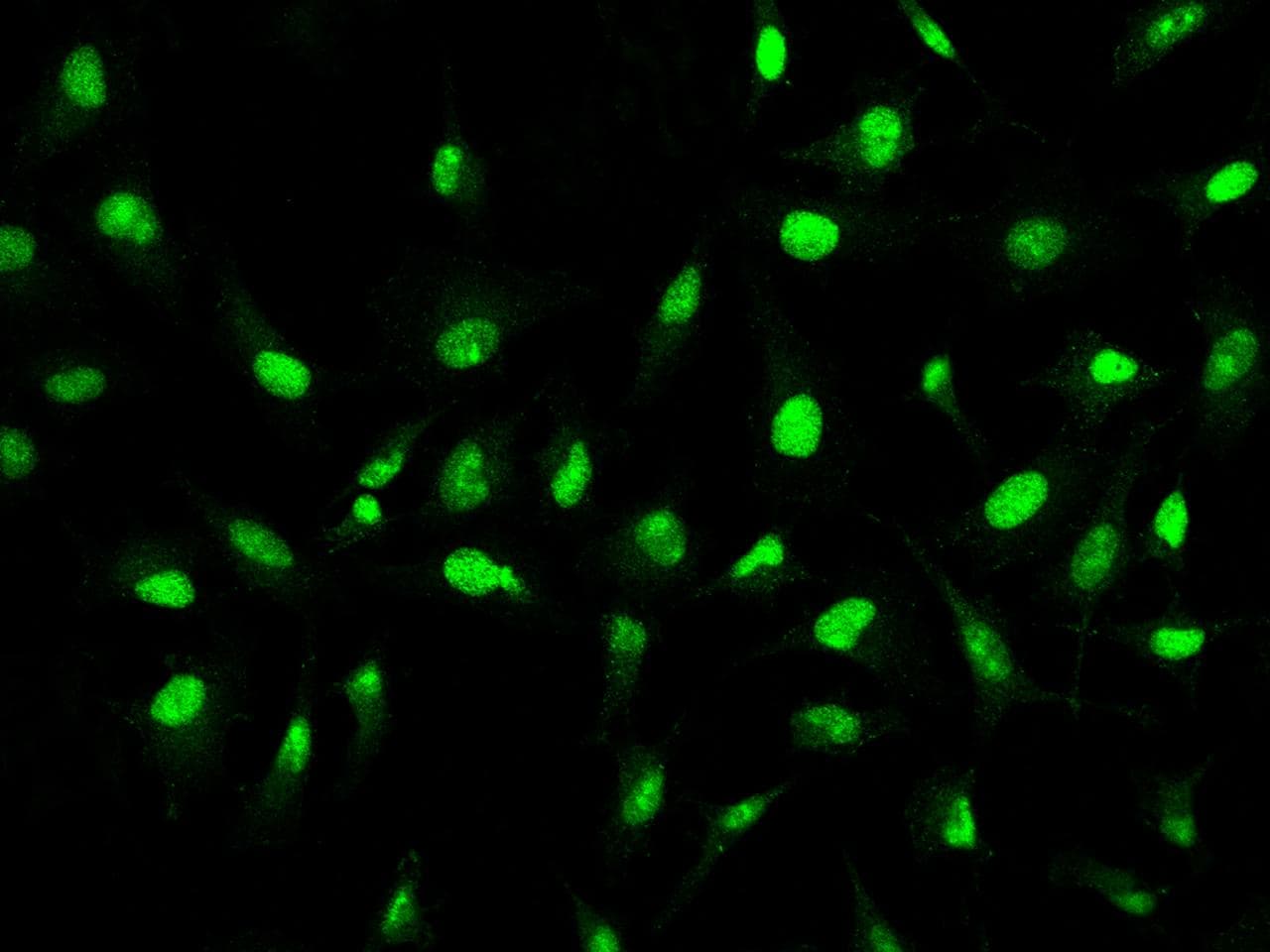 ZCCHC9 Antibody