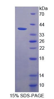 Human MLYCD / MCD Protein (Recombinant His-T7)