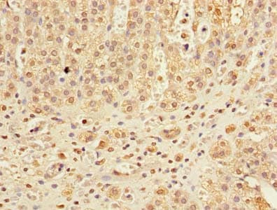 Polyclonal Rabbit anti-Human DHX30 Antibody (IHC)