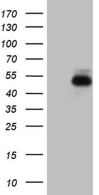 Monoclonal Mouse anti-Human RORB / ROR Beta Antibody (clone OTI1G1, Carrier-free, aa1-260, IHC, WB)