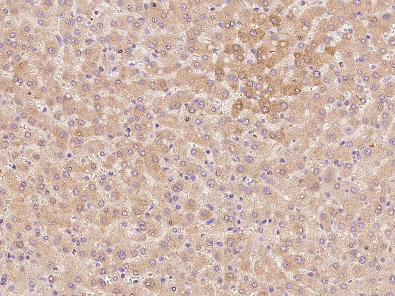 Polyclonal Rabbit anti-Human THRSP Antibody (IHC, IF)
