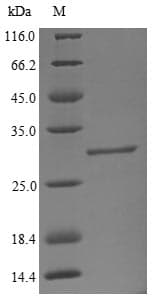 Bovine B4GALT1 Protein (Recombinant GST, N-terminus)