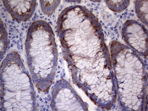 LGALS3 / Galectin 3 Antibody (clone OTI9C7)
