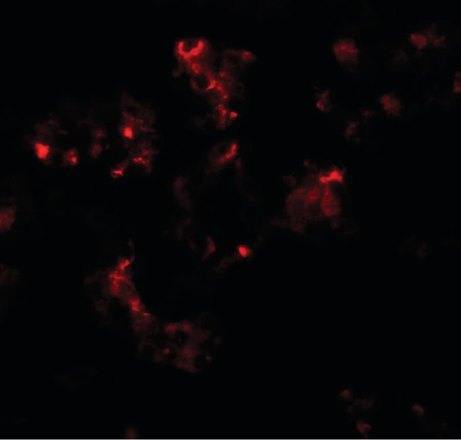 IHC-plus™ Polyclonal Rabbit anti-Human TTYH2 Antibody (IHC, IF, WB)