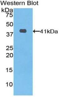 KRT6A / CK6A / Cytokeratin 6A Antibody (aa163-468, Biotin)