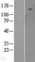 ULK2 Protein (Over-Expression Lysate Myc-DDK (Flag))