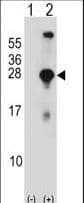 Polyclonal Rabbit anti-Human SNAP23 / SNAP-23 Antibody (aa170-199, IHC, WB)