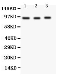 FER Antibody (aa521-536)