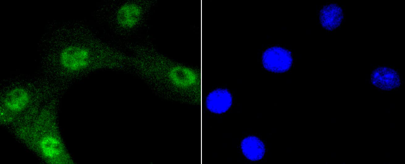 Monoclonal Rabbit anti-Human AKT1 Antibody (phospho-Ser473, IHC, IF, WB)