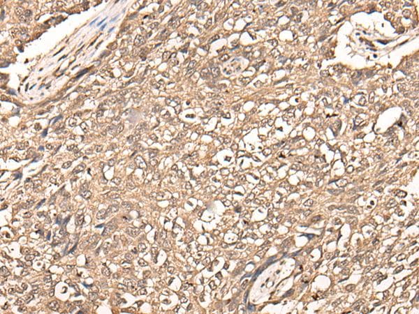 USP21 Antibody