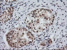 Monoclonal Mouse anti-Human MGLL / Monoacylglycerol Lipase Antibody (clone OTI1H1, IHC, IF, WB)