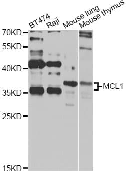 Polyclonal Rabbit anti-Human MCL1 / MCL 1 Antibody (IHC, IF, WB)