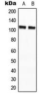 Polyclonal Rabbit anti-Human AGBL2 / CCP2 Antibody (C-Terminus, IHC, WB)