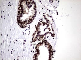 Monoclonal Mouse anti-Human NBN / Nibrin Antibody (clone OTI8E7, IHC, WB)