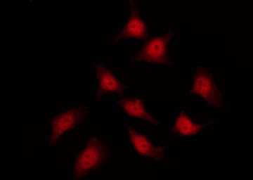 HSPB1 / HSP27 Antibody (phospho-Ser82)