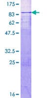 Human MTA3 Protein (Recombinant GST)