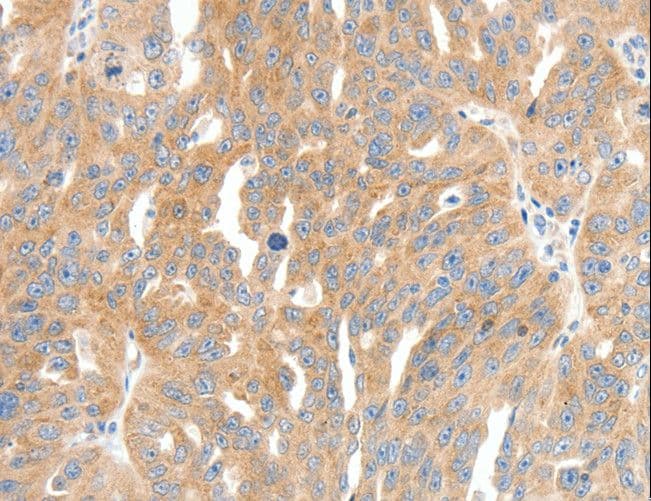 COL4A1 / Collagen IV Alpha1 Antibody