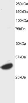 IHC-plus™ ATF7 Antibody (aa482-494)