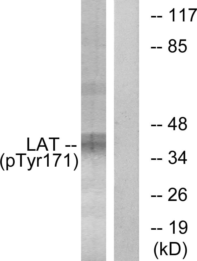 LAT Antibody (phospho-Tyr171)