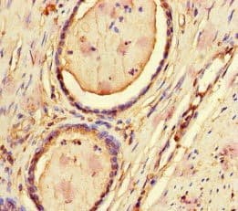 CFL1 / Cofilin Antibody