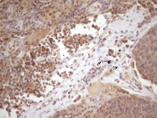 PRPK / TP53RK Antibody (clone OTI5B2)
